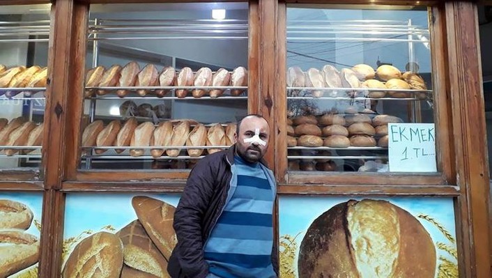 Турецкому пекарю сломали нос за продажу дешевого хлеба