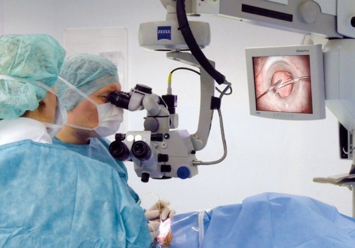 Турецкие врачи удалили из слюнной железы пациента огромный камень