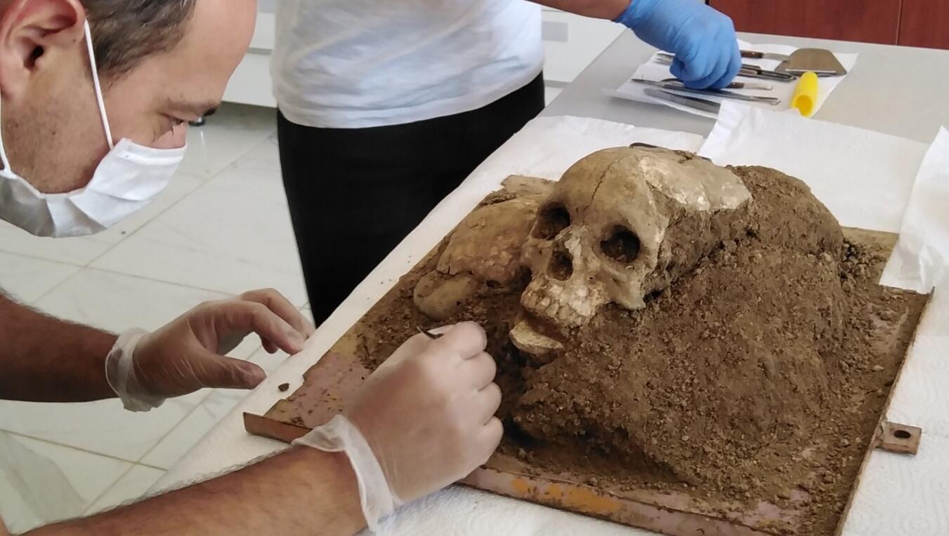 Найденный в Чоруме 3,500-летний череп изменит историю