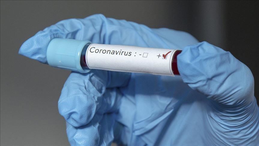 В Турцию доставлены лекарства от коронавируса Covid-19