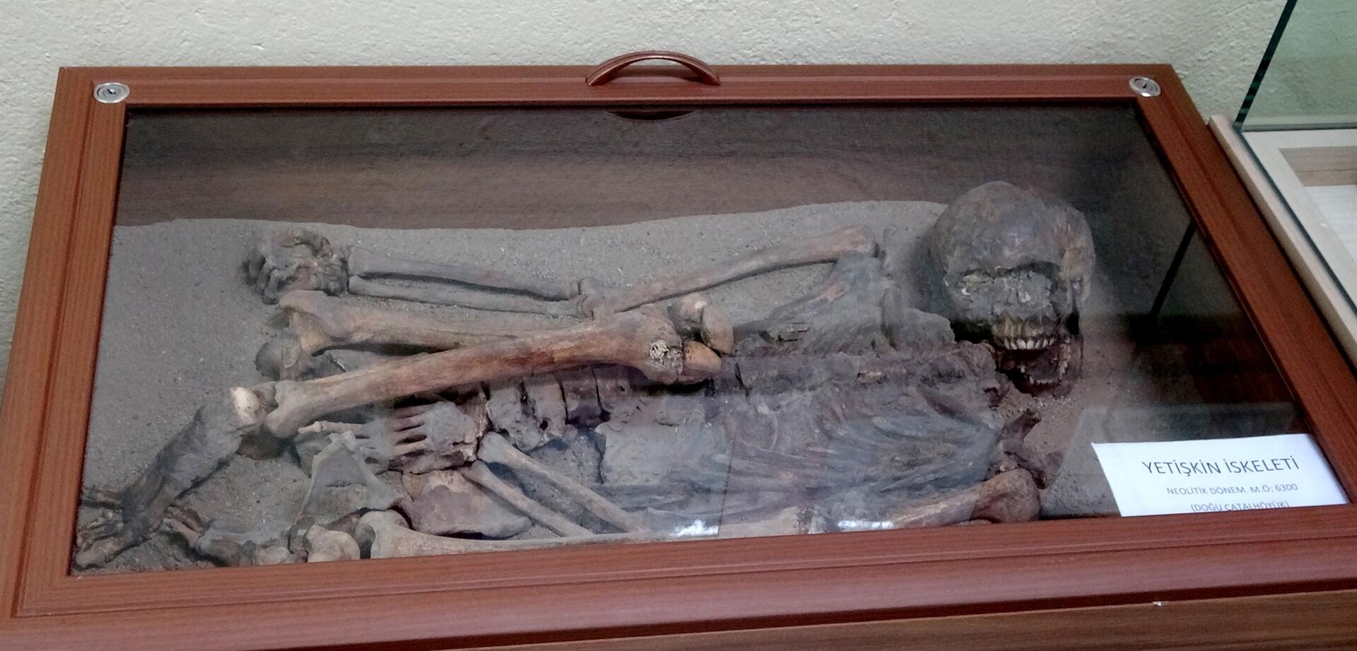 Человеческие скелеты возрастом 9 тыс лет выставлены в турецком музее