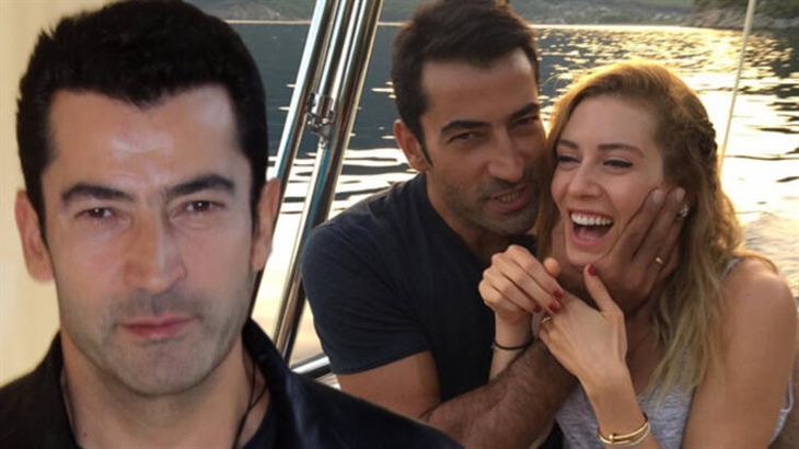 Известный турецкий актер пересадил волосы за 15 тысяч