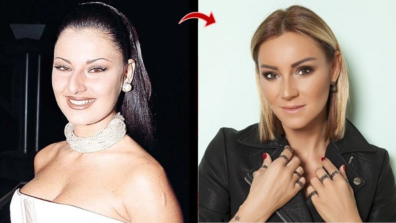 Как ринопластика изменила турецких актрис  (ВИДЕО)