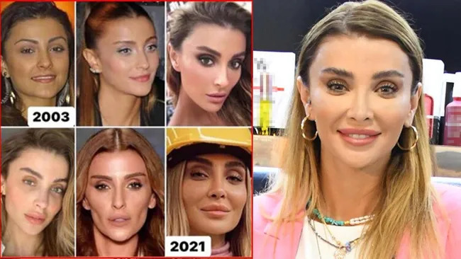 Эволюция внешности турецких актрис: чудеса без пластики