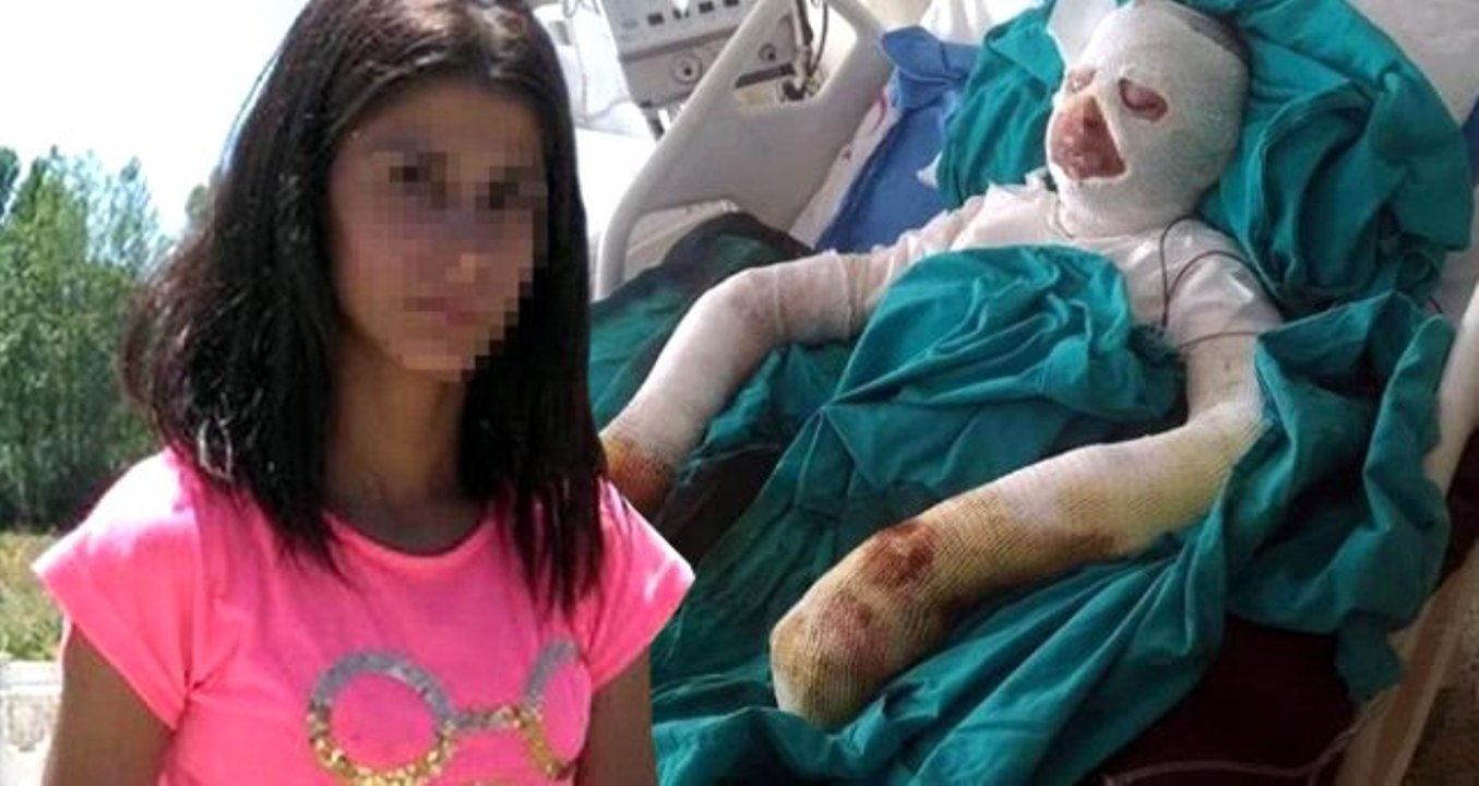 Турецкая девушка вымыла волосы бензином и едва не сгорела