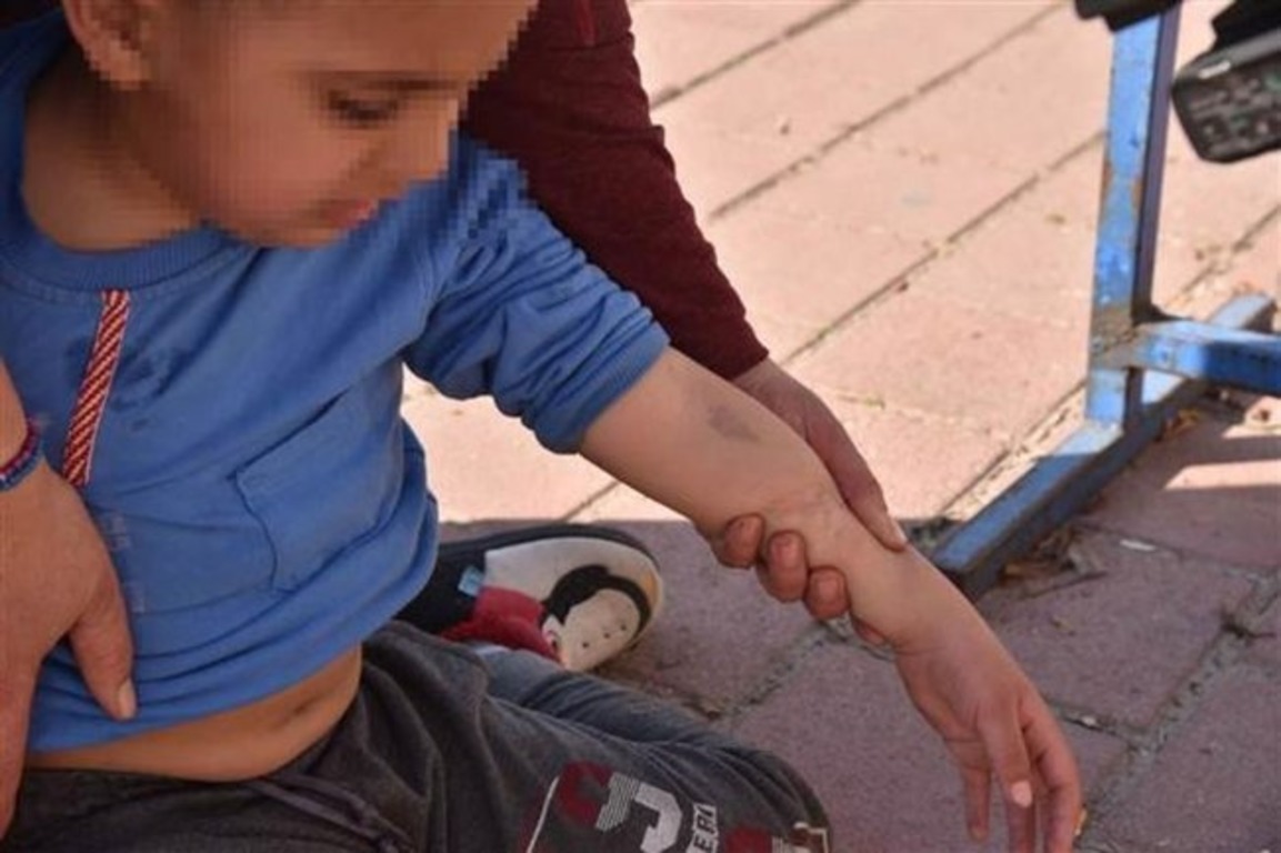 В Анталье ребенок-инвалид подвергся насилию в школе
