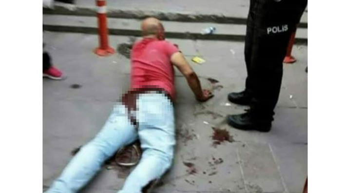 Отец пытался кастрировать пристававшего к его дочери мужчину в Анкаре (фото и видео)