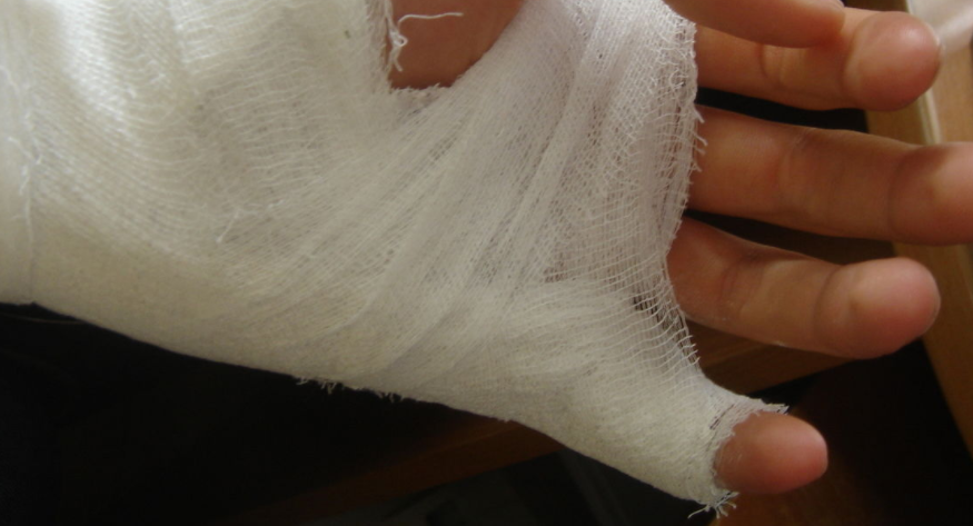 Стюардесса сломала палец ребенку на рейсе “Екатеринбург-Анталия”
