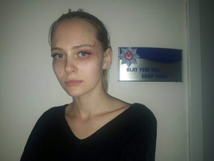 Украинская модель подверглась насилию со стороны нанимателя в Стамбуле