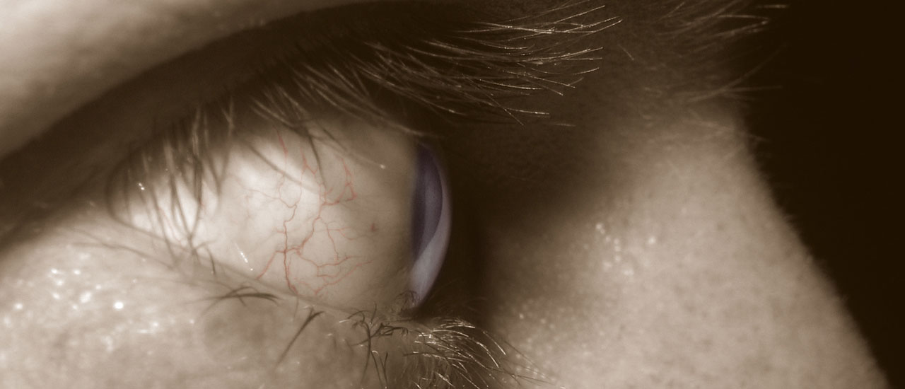 Микрохирургия глаза в Турции: опыт реальных пациентов