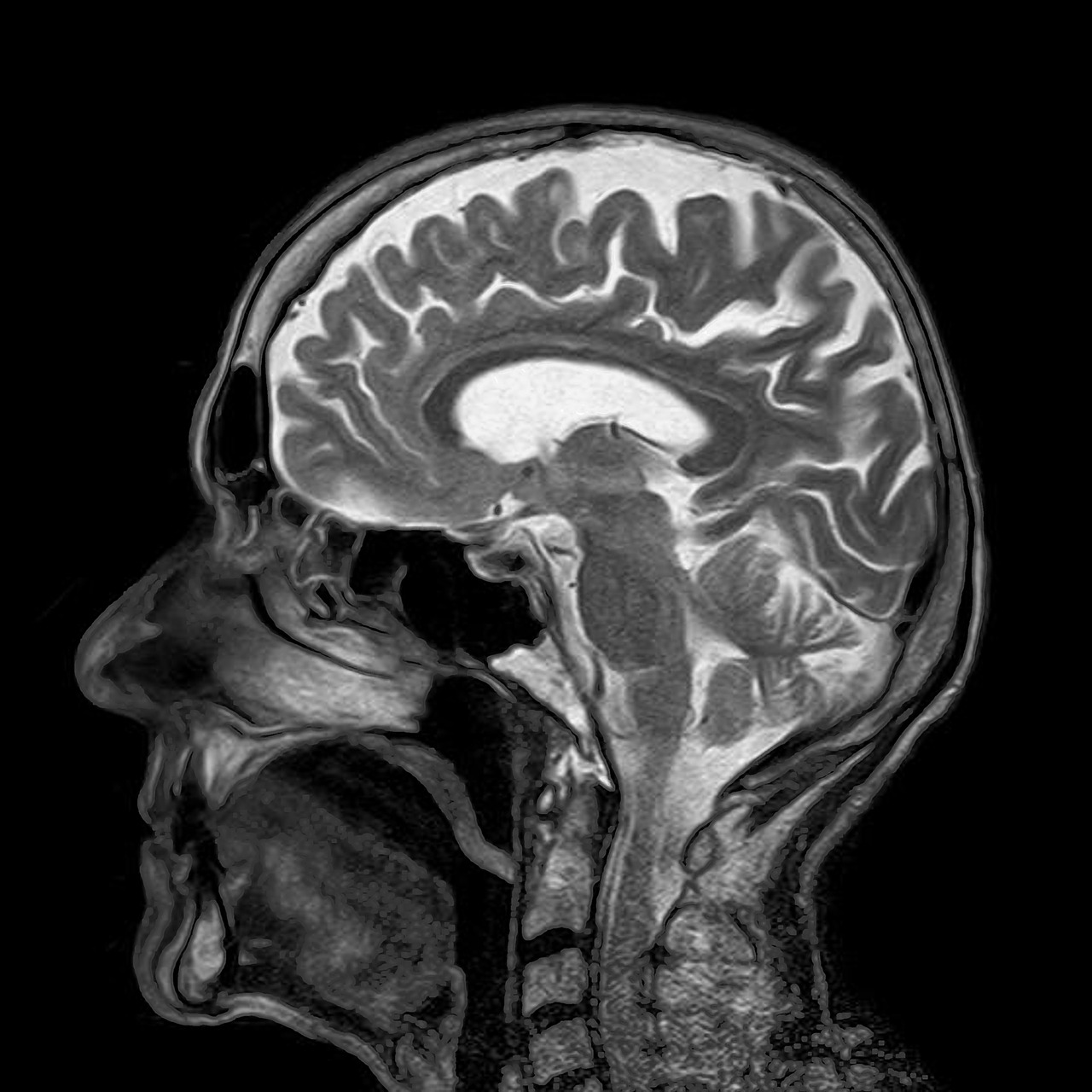   Процедура МРТ головного мозга в клиниках Анталии 