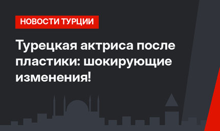 Турецкая актриса после пластики: шокирующие изменения!
