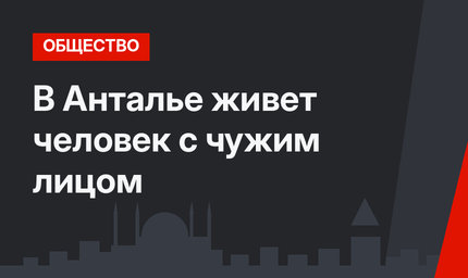 В Анталье живет человек с чужим лицом