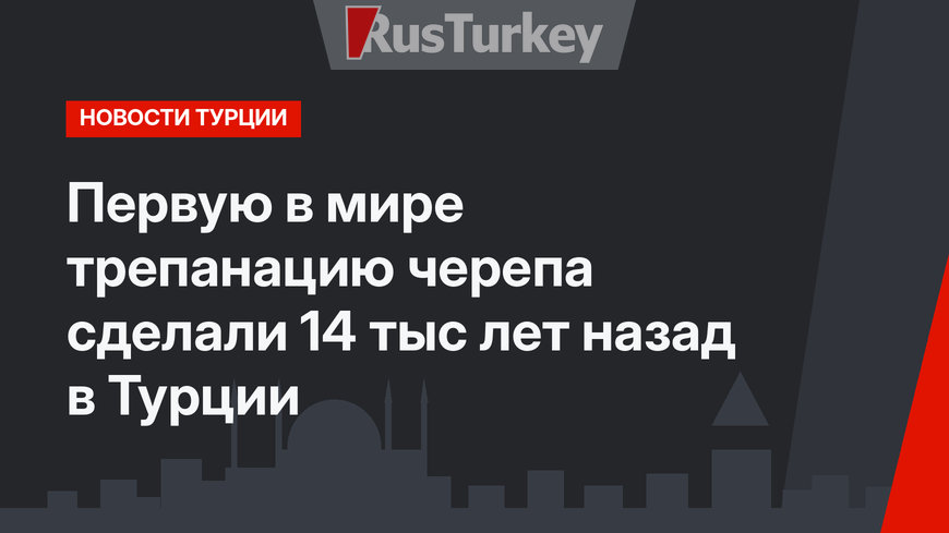 Первую в мире трепанацию черепа сделали 14 тыс лет назад в Турции