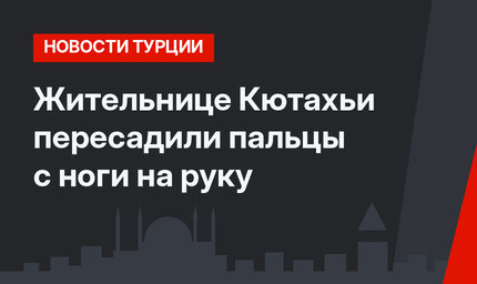 Жительнице Кютахьи пересадили пальцы с ноги на руку