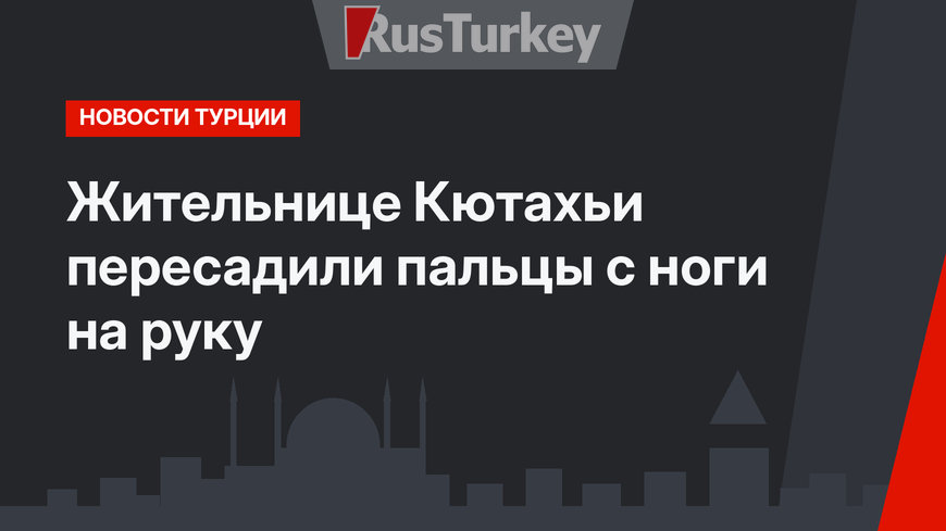 Жительнице Кютахьи пересадили пальцы с ноги на руку