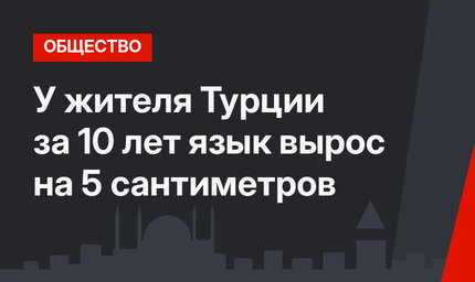 У жителя Турции за 10 лет язык вырос на 5 сантиметров