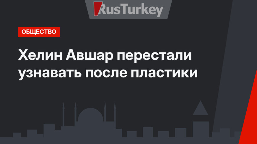 Хелин Авшар перестали узнавать после пластики