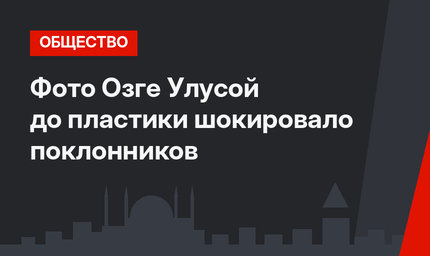 Фото Озге Улусой до пластики шокировало поклонников