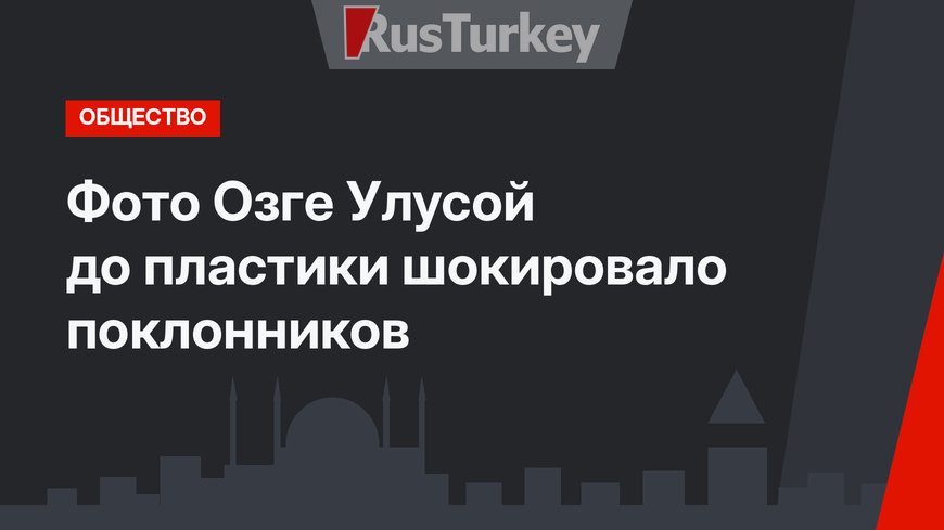 Фото Озге Улусой до пластики шокировало поклонников