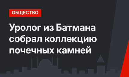 Уролог из Батмана собрал коллекцию почечных камней