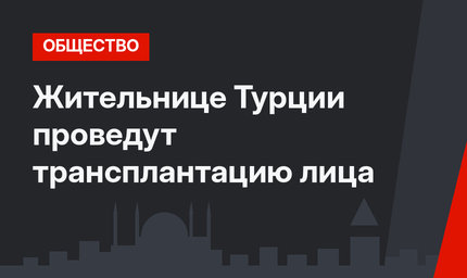 Жительнице Турции проведут трансплантацию лица