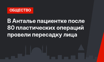 В Анталье пациентке после 80 пластических операций провели пересадку лица