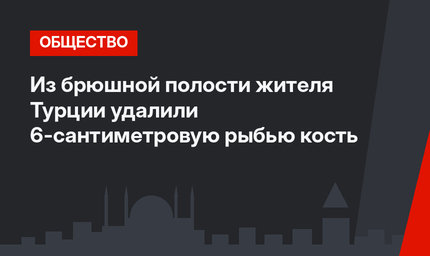 Из брюшной полости жителя Турции удалили 6-сантиметровую рыбью кость