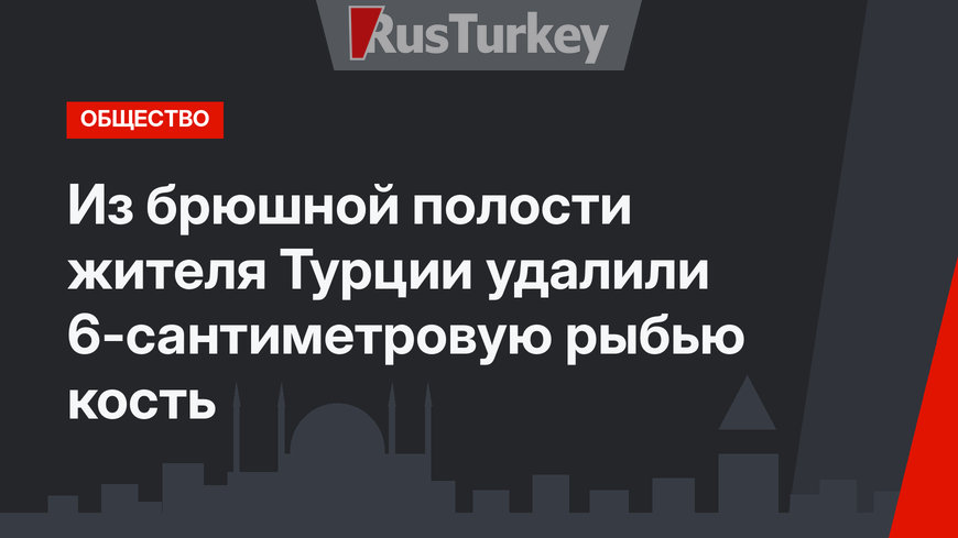 Из брюшной полости жителя Турции удалили 6-сантиметровую рыбью кость