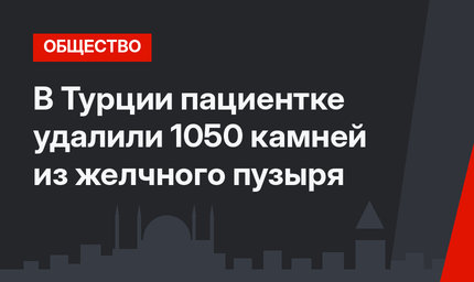 В Турции пациентке удалили 1050 камней из желчного пузыря
