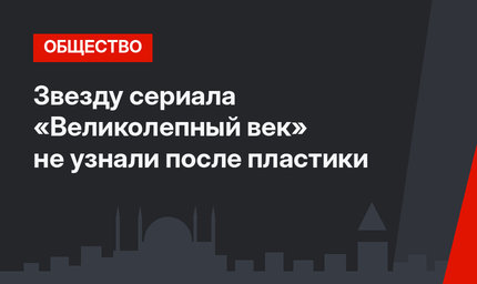 Звезду сериала «Великолепный век» не узнали после пластики