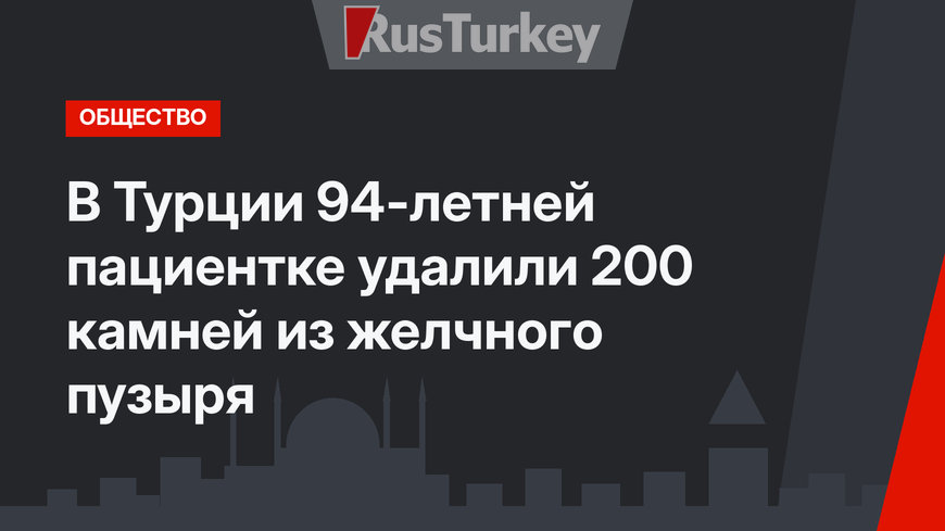 В Турции 94-летней пациентке удалили 200 камней из желчного пузыря