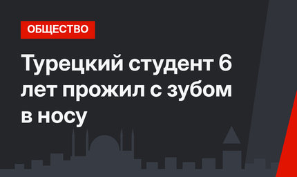 Турецкий студент 6 лет прожил с зубом в носу