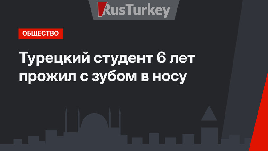 Турецкий студент 6 лет прожил с зубом в носу