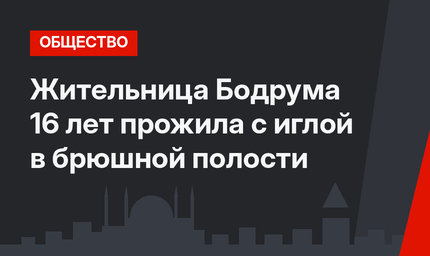 Жительница Бодрума 16 лет прожила с иглой в брюшной полости