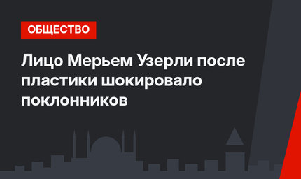 Лицо Мерьем Узерли после пластики шокировало поклонников