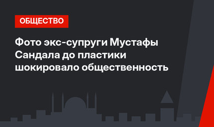 Фото экс-супруги Мустафы Сандала до пластики шокировало общественность