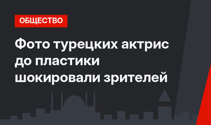 Фото турецких актрис до пластики шокировали зрителей