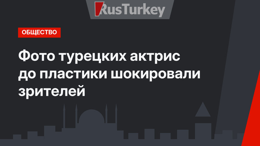 Фото турецких актрис до пластики шокировали зрителей