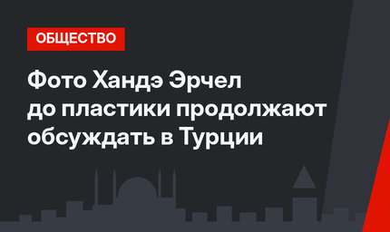 Фото Хандэ Эрчел до пластики продолжают обсуждать в Турции 