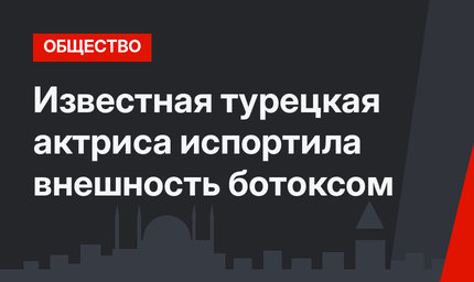 Известная турецкая актриса испортила внешность ботоксом