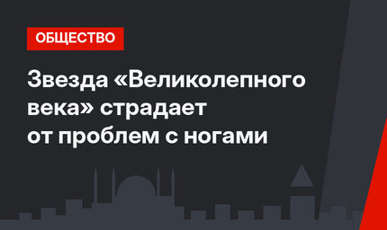Звезда «Великолепного века» страдает от проблем с ногами