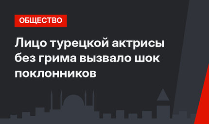 Лицо турецкой актрисы без грима вызвало шок поклонников
