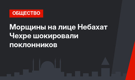 Морщины на лице Небахат Чехре шокировали поклонников