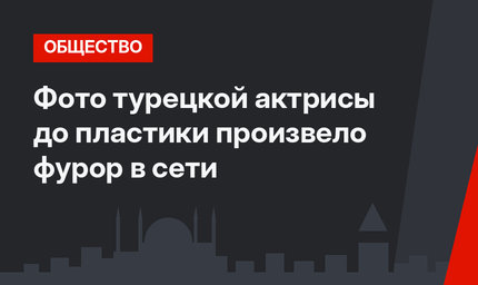 Фото турецкой актрисы до пластики произвело фурор в сети