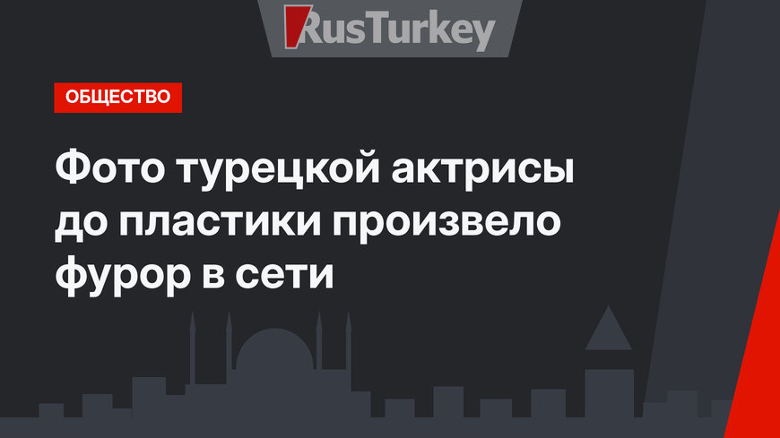 Фото турецкой актрисы до пластики произвело фурор в сети