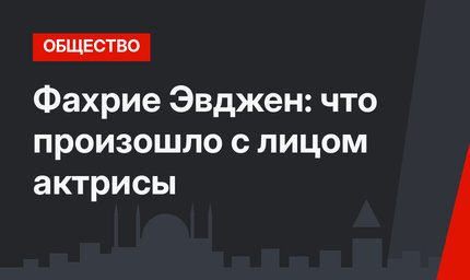 Фахрие Эвджен: что произошло с лицом актрисы