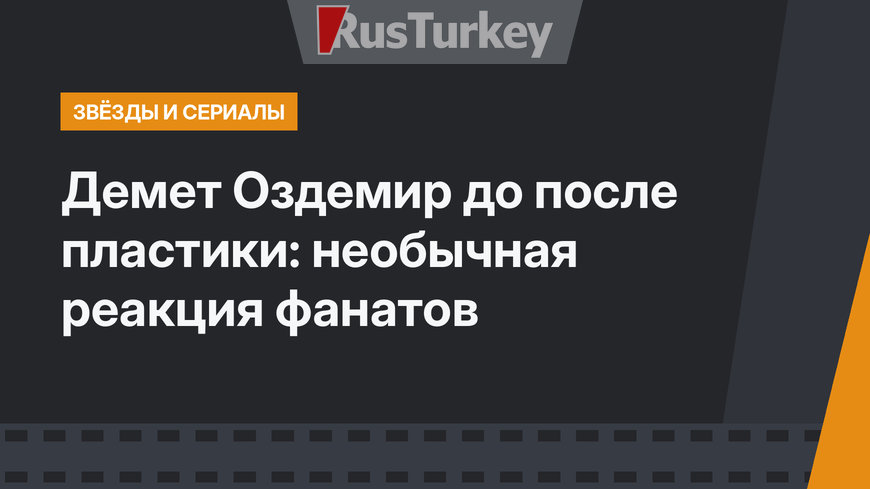 Демет Оздемир до после пластики: необычная реакция фанатов 