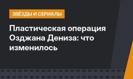 Пластическая операция Озджана Дениза: что изменилось