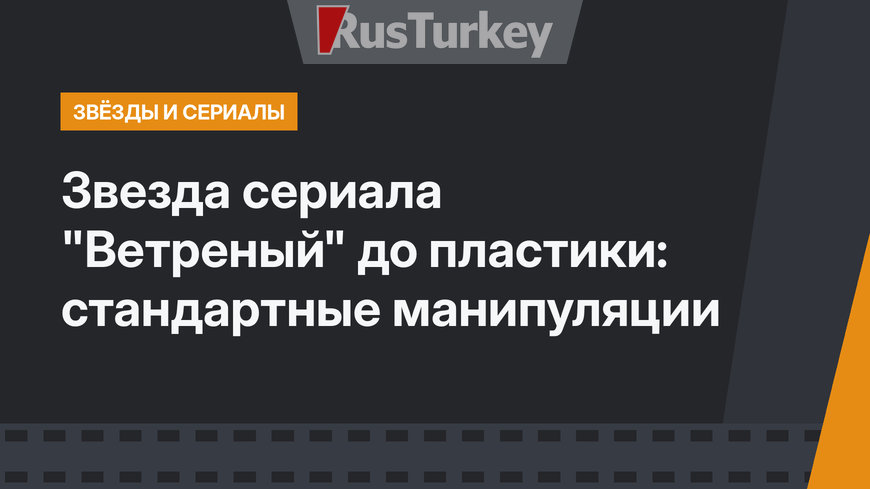 Звезда сериала "Ветреный" до пластики: стандартные манипуляции